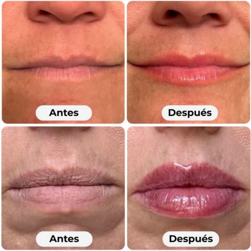 Labios Perfectos™ Volumen Plus - Compra 1 y llévate 2